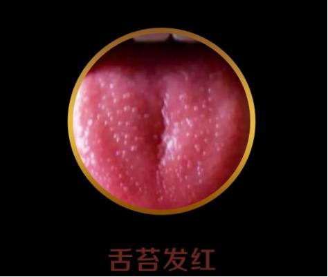 舌头有舌象是什么原因,怎么判断宝宝舌象是否正常