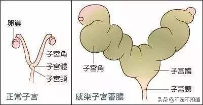 狗狗子宫蓄脓绝育后怎么办,狗狗子宫蓄脓直接绝育可以吗