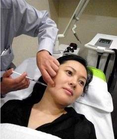 一些注射了玻尿酸的女人,那些做医美的女人最后怎么样了