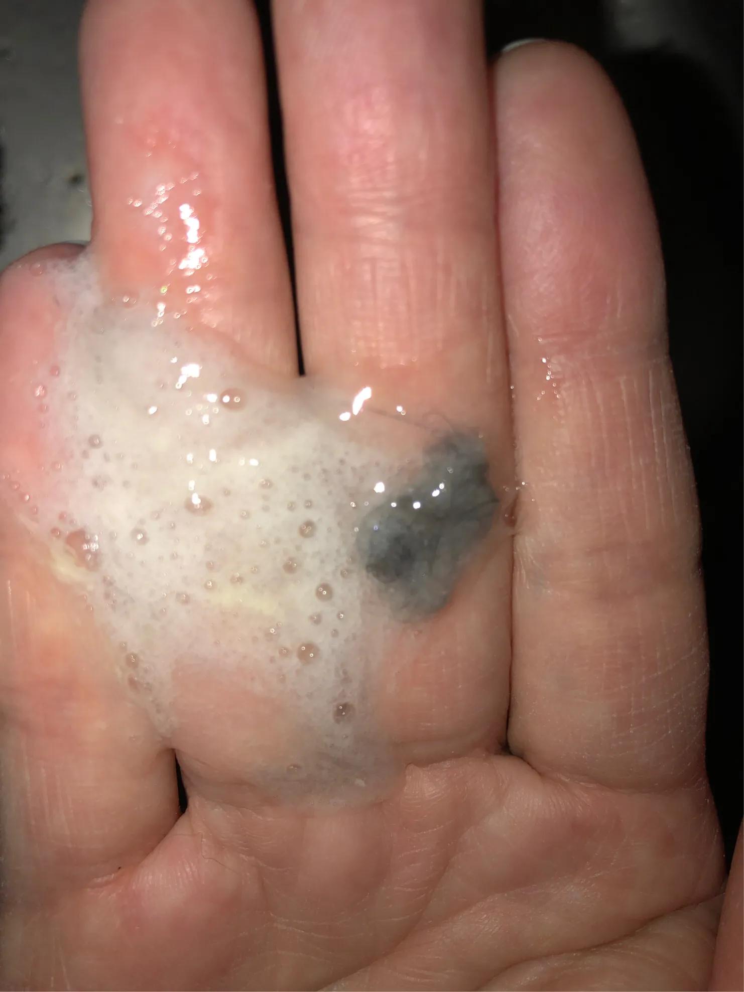 猫猫肠胃炎需要隔离吗,猫猫胃肠炎的症状及治疗方法