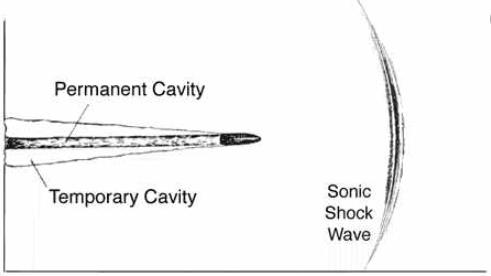 战伤救治常用技术病例分析题,战伤外科处理
