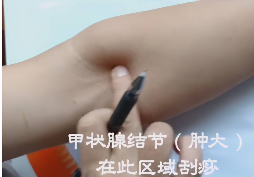 肝郁的人容易焦虑吗,肝郁是肝上有结节吗