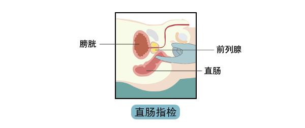 一文读懂痛风,一文读懂类风湿
