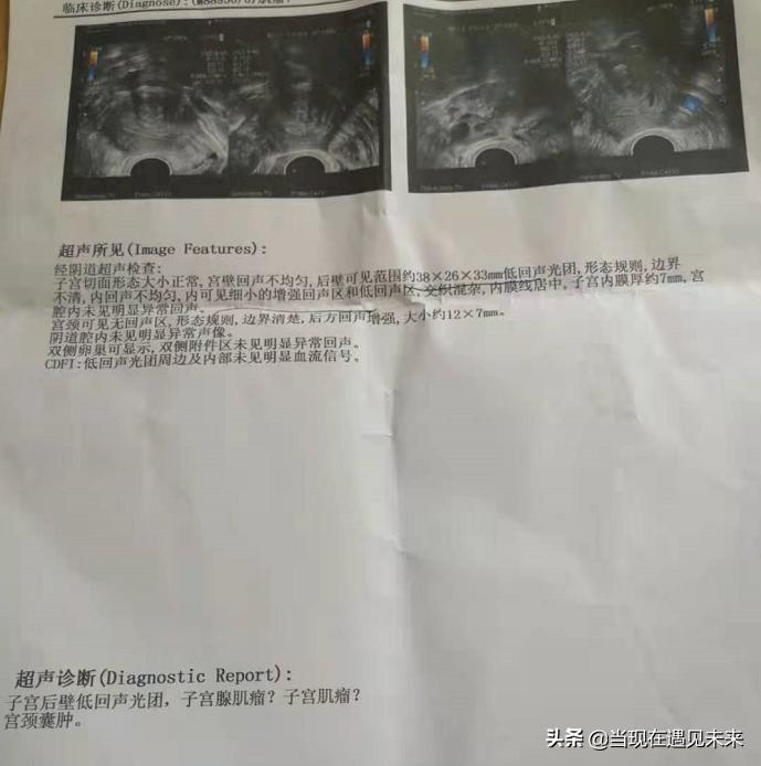 42岁子宫肌瘤备孕两个月没怀孕,备孕子宫肌瘤4厘米