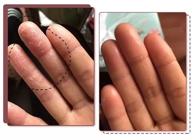 蔡依林皮肤特护霜,蔡依林胶原蛋白粉保养皮肤