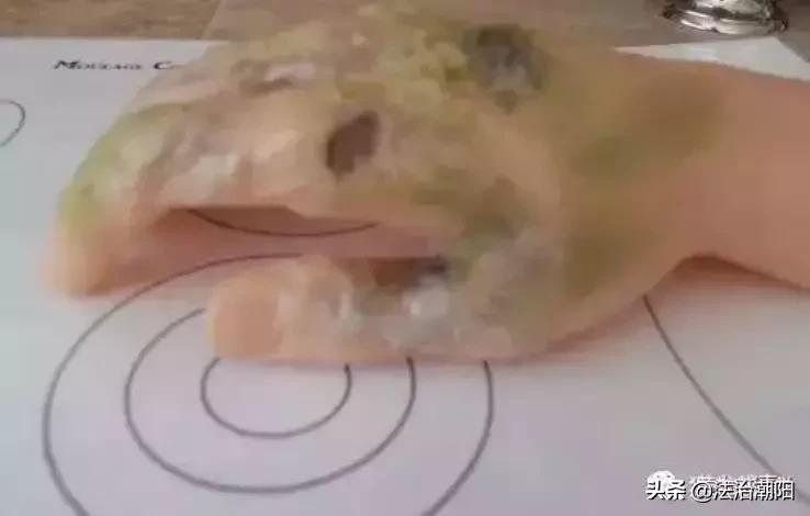 让人皮肉腐烂的细菌,让人尸体发黑的毒是什么