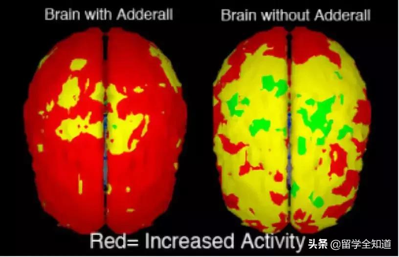 毁了一代美国学生的“聪明药”，现在开始祸害中国孩子了