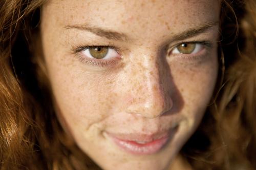 怎么区分脸上是什么斑,脸上斑怎么区分