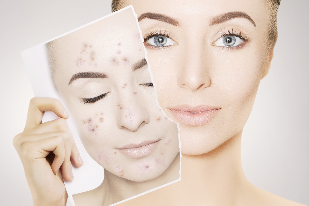 肤色不匀怎么改善内调,肤色不匀怎么改善用什么护肤