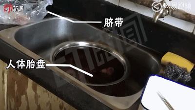 浜轰綋鑳庣洏鏈夌瀵嗗悧,鎻浜轰綋鑳庣洏