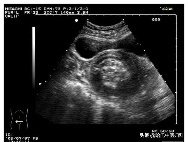 跟婆婆住一个套房总是被气怎么办,和婆婆住一起每天被气的要死