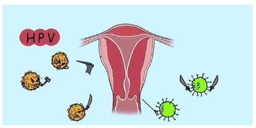 子宫切除后hpv高危怎么办,子宫全切后高危hpvmrna阳性