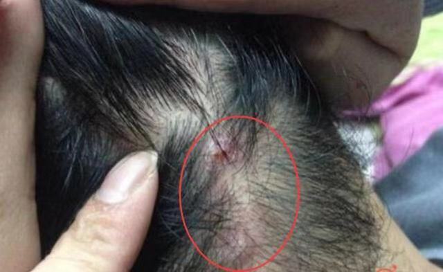 洗发水买无硅油的还是含硅油的,无硅油洗发水好还是有硅油的好