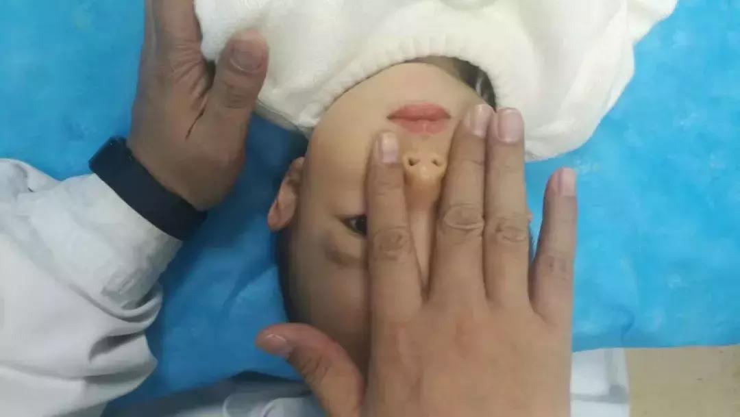 鼻炎与鼻窦炎的区别是什么,鼻窦炎和鼻炎的对比