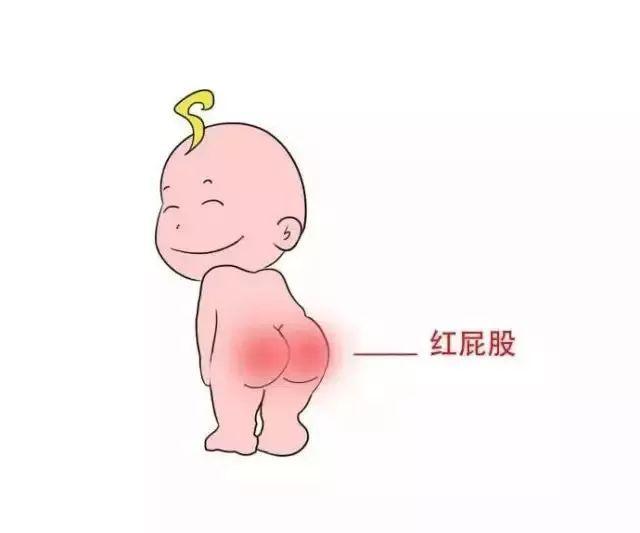 朵拉纸尿裤超级柔软透气,朵拉纸尿裤98元3包