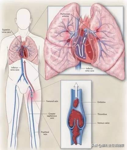 不想去医院第二弹！胸部不适的自我诊察