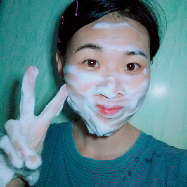 孕期用凯妮汀安全吗,孕妇可以用艾璐卡护肤