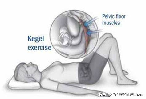 产后漏尿多久凯格尔能恢复,产后一年漏尿是什么原因引起的