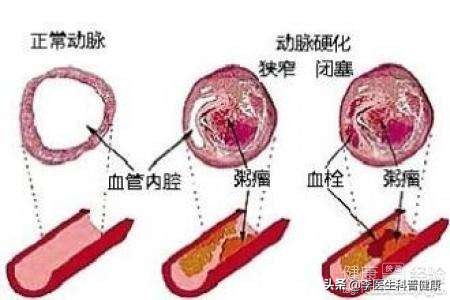 头晕脑胀记忆力差怎么回事,头晕脑胀记忆力减退易怒