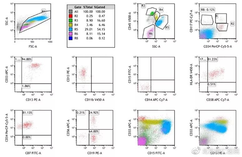 白血病急淋b型骨髓移植后复发率,髓系白血病m2移植后复发几率