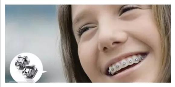 牙齿矫正有几种方式,牙齿矫正刷牙方式视频