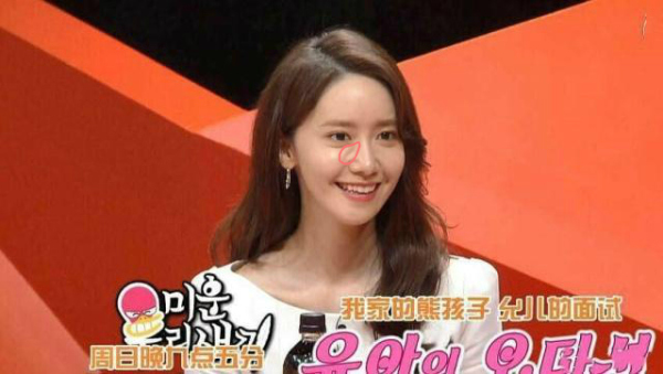 20岁淡化眼部细纹,20岁眼下有细纹怎么办