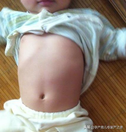 出牙缺钙吃什么补钙,孩子10个月多了不出牙需要补钙么