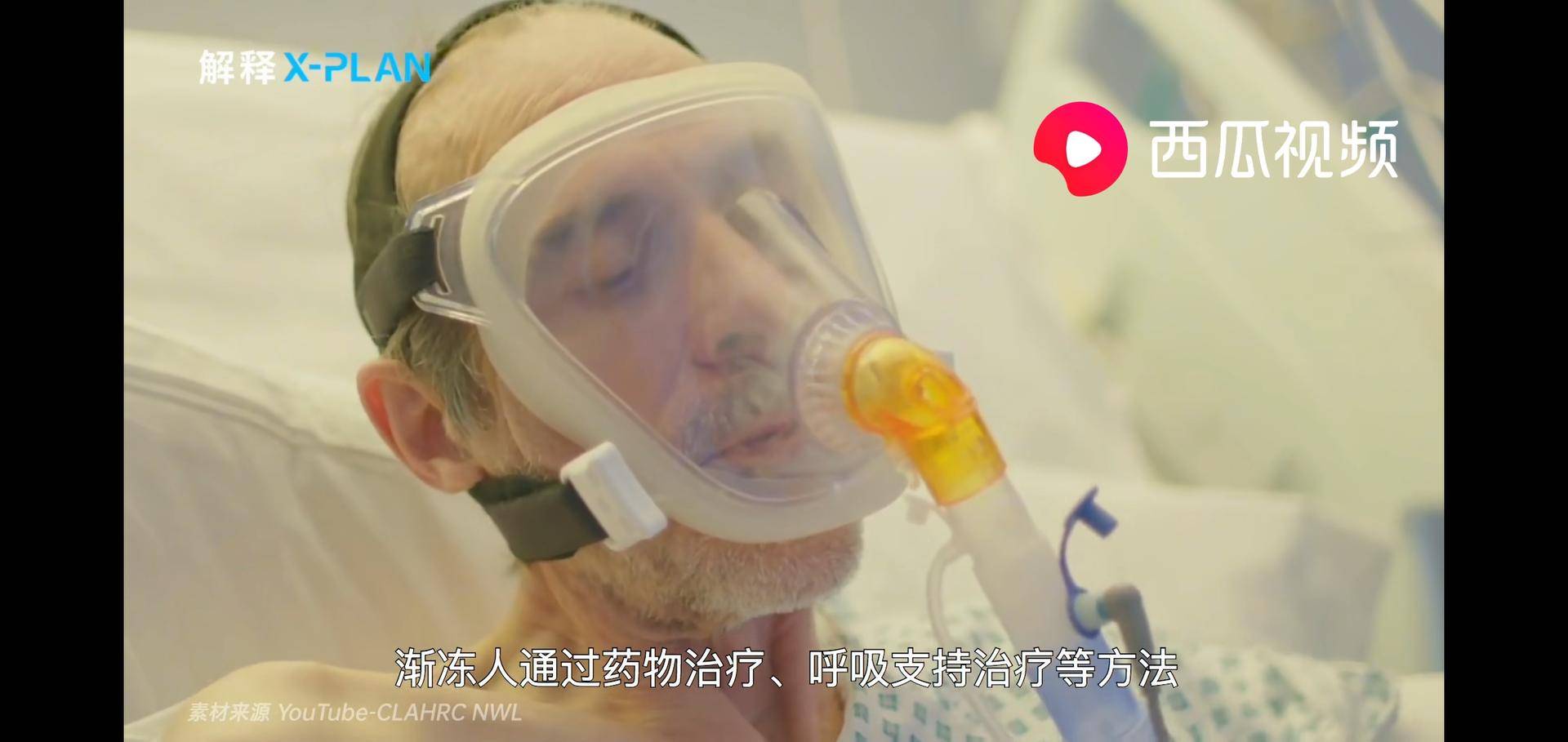 西瓜视频脊髓病变,西瓜视频医学科普