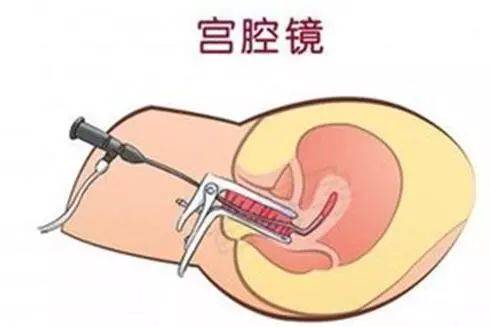 下身出血半年不止是怎么了,体下流血