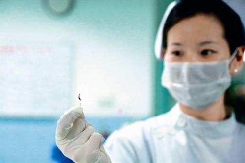 吃鱼扎嗓子怎么办,吃鱼卡刺了喝醋有用吗