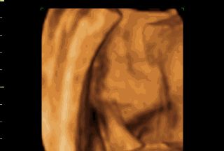 孕六个月四维胎儿做了个鬼脸,四维彩超胎儿做鬼脸