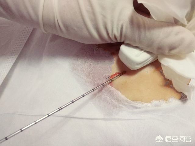 乳房有问题用什么仪器检查最好,乳腺超声检查可以排除乳腺癌吗