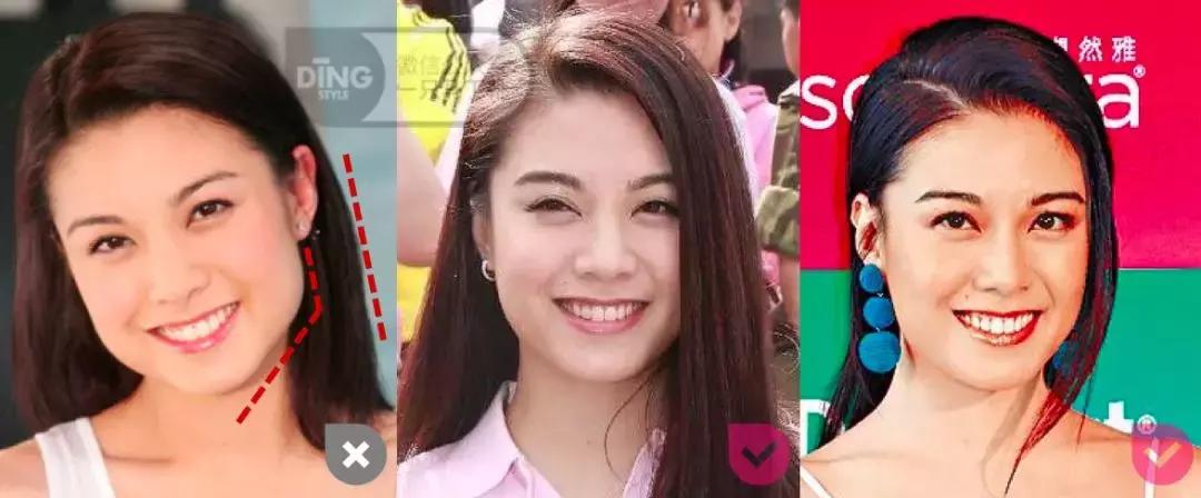 脸大小不对称怎么矫正,如何改善大小脸不对称