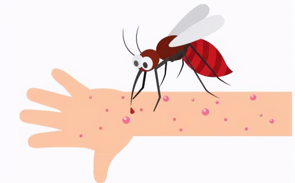 蚊虫叮咬后怎么处理最合适,蚊虫叮咬第一时间怎么处理