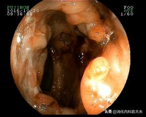 俞大夫讲解视频,俞大夫的讲座