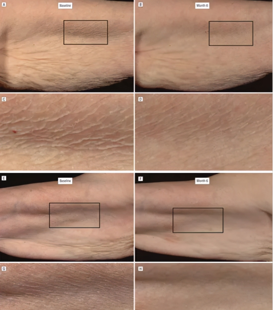 现在最流行的a醇,公认的a醇值得用吗