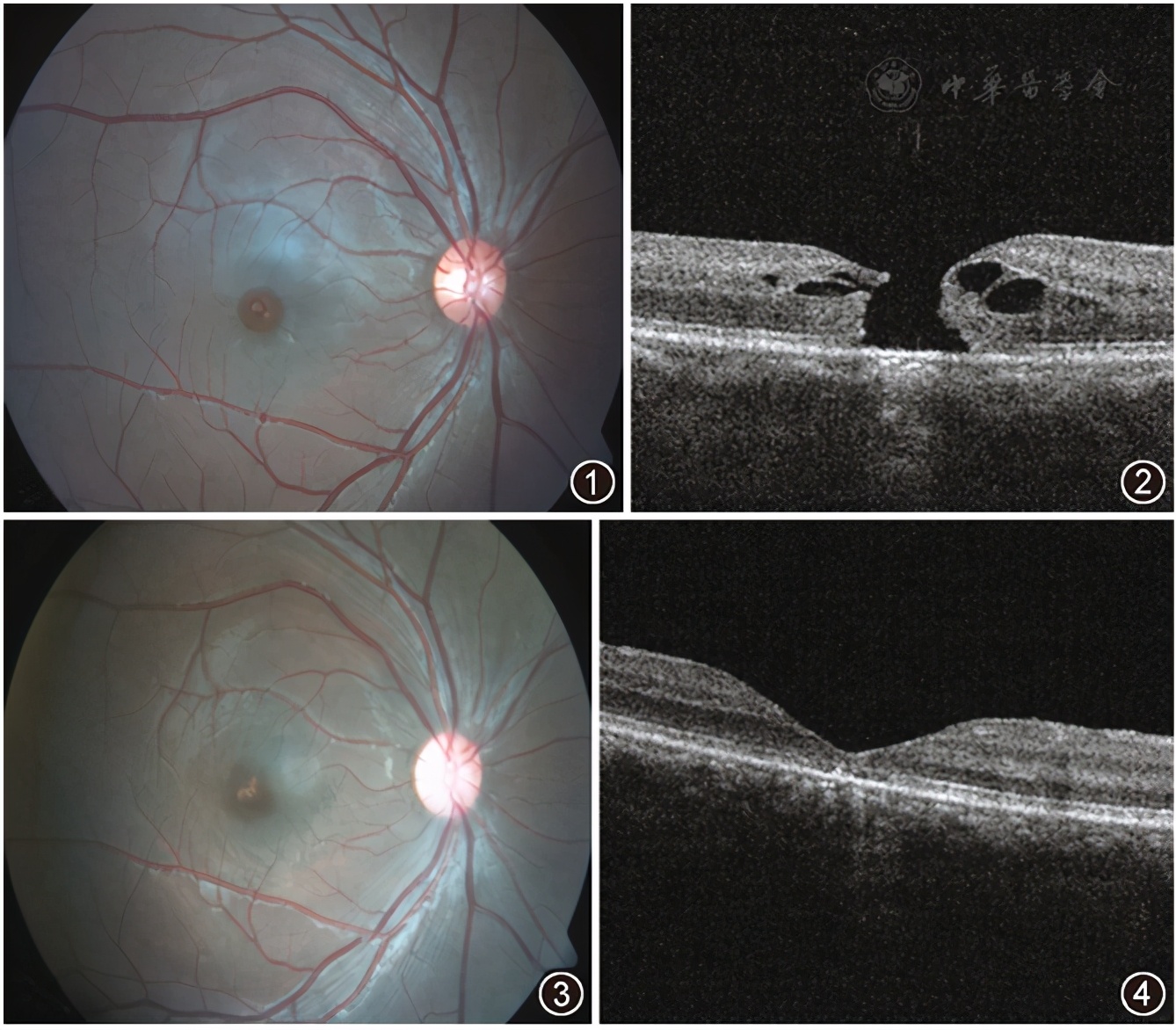 19岁熊孩子用激光笔照射民航飞机,十六岁的熊孩子用激光灯照射飞机