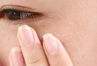 化妆搓泥是什么样子的,化妆搓泥和起皮的区别