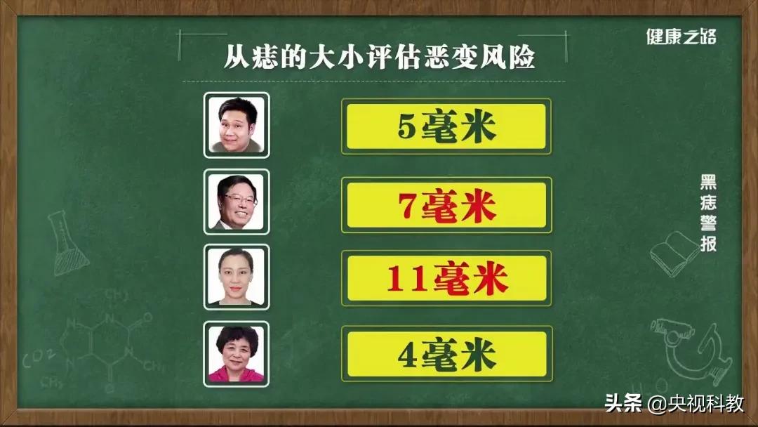 黑痣很容易恶变吗,身上黑痣出现什么状况有癌变发生