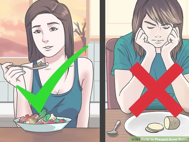 长完痘的红色痘坑怎么弄,怎么预防痘坑形成