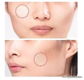 颧骨内推怎么改善脸型,颧骨内推和颧突有什么区别