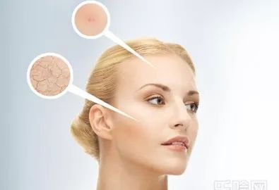 脸上有刺痒感是怎么回事,脸部皮肤刺痒怎么回事