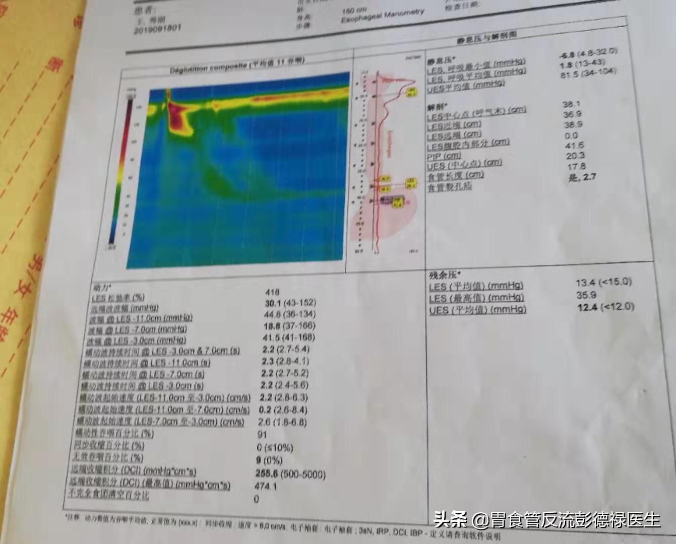 胃胀二十年,胸闷气短是胃胀还是食管反流