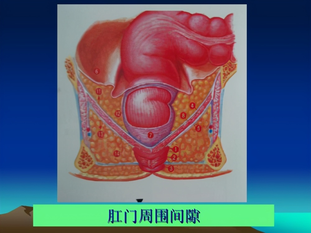 直肠内全层套叠要尽快手术吗,成人直肠套叠是肠癌吗