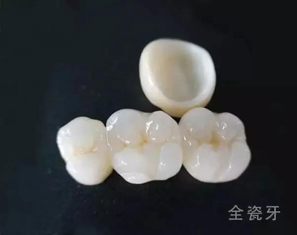 明星的牙都是真牙吗,如何辨别优秀的牙医