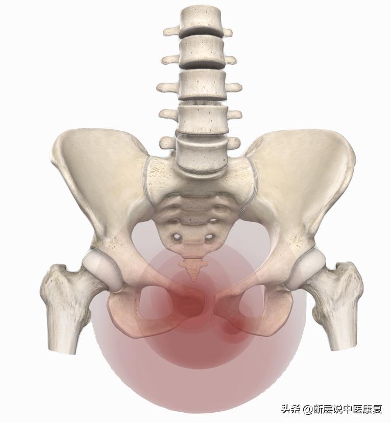 妇科盆腔疼痛症,盆腔筋膜炎如何彻底治愈