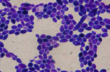 妇科病:白带异常是多种疾病的警示信号,应对方案及调节方法