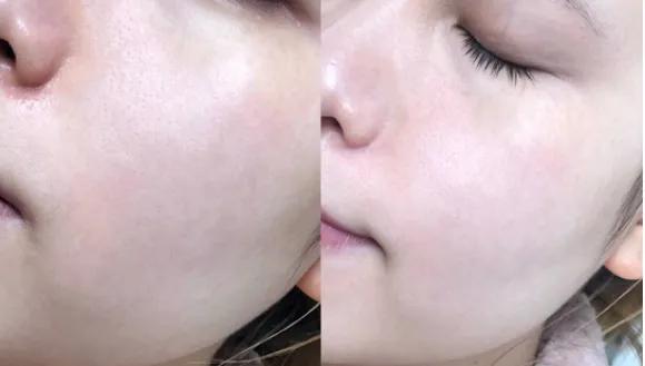 黛珂植物韵律水乳清爽滋润怎么选,黛珂植物韵律水乳清爽和滋润