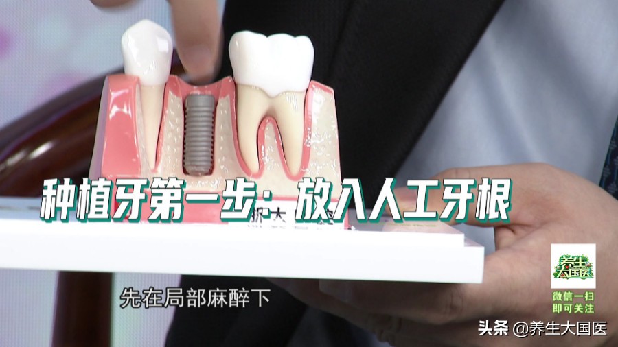 牙齿不整齐怎么修复最快,牙齿不好看如何迅速矫正