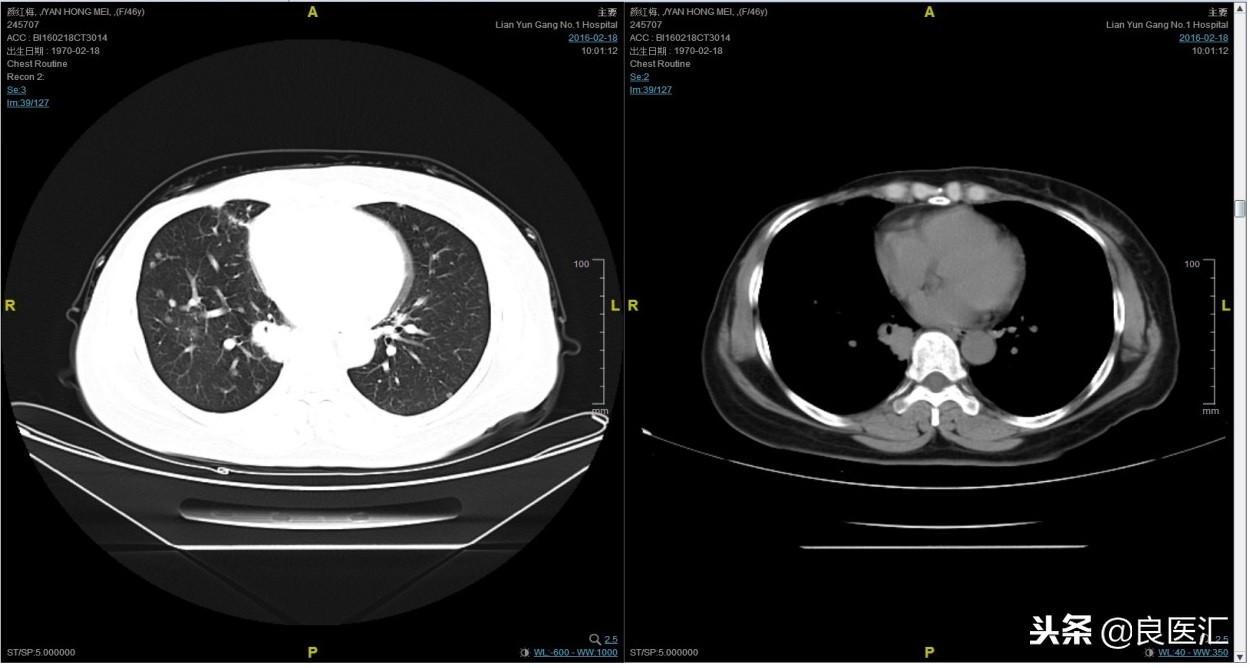 美图秀秀成功案例,美图秀秀实战案例